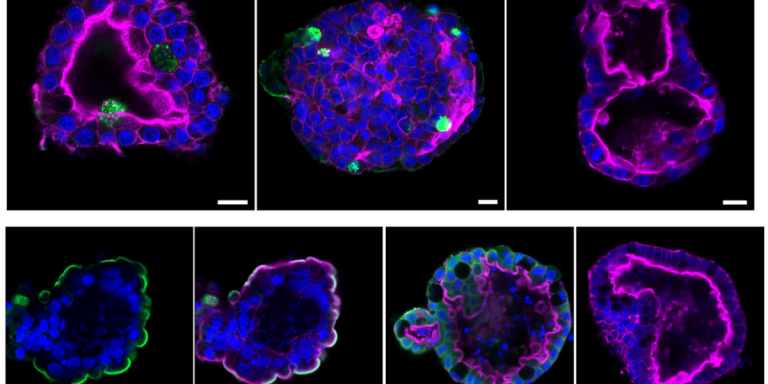 Lab-grown mini-lungs could reveal why covid-19 kills