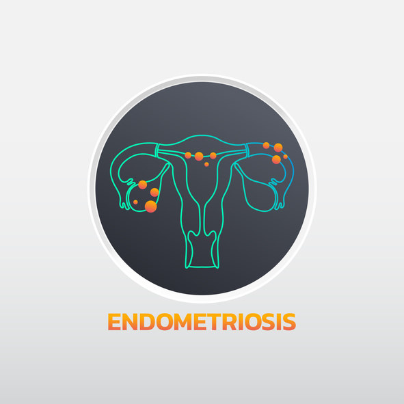 Treating the pain of endometriosis – Harvard Health Blog