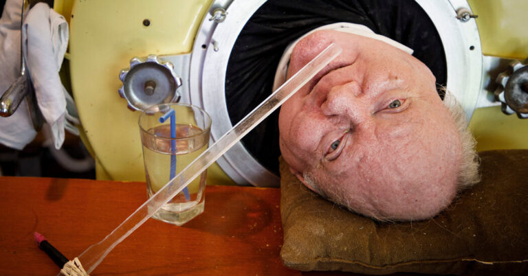 Paul Alexander, Polio Survivor Who Lived in Iron Lung for 70 Years, Dies age 78